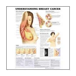  Understanding Breast Cancer Anatomical Chart 20 X 26 