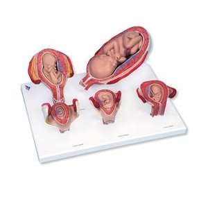  Standard Pregnancy Series 5 Models