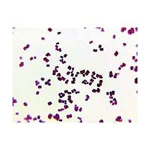 Prepared Slide, Cocci in Chains (Streptococci), Stained  