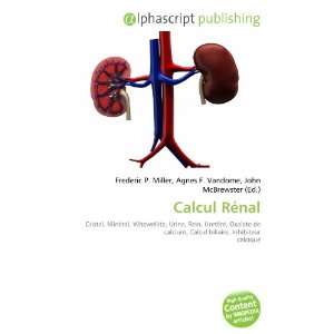  Calcul Rénal (French Edition) (9786132884206) Books