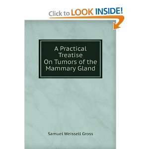  A Practical Treatise On Tumors of the Mammary Gland 