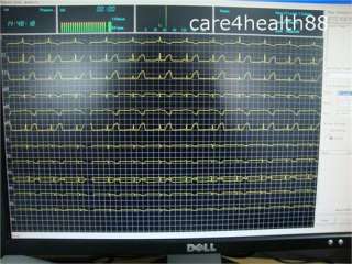 CH**12 LEAD**color ECG EKG machine with  